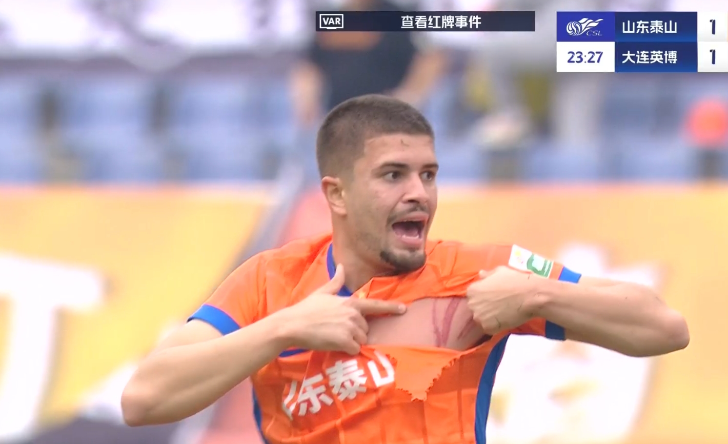  大連少打一人！卡蘭加蹬踏直紅，卡扎爾球衣被蹬爛+胸部三道血痕