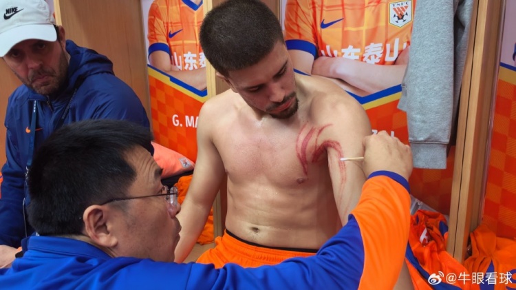  硬漢！記者曬卡扎爾受傷照，肩胛及上臂處多條血痕