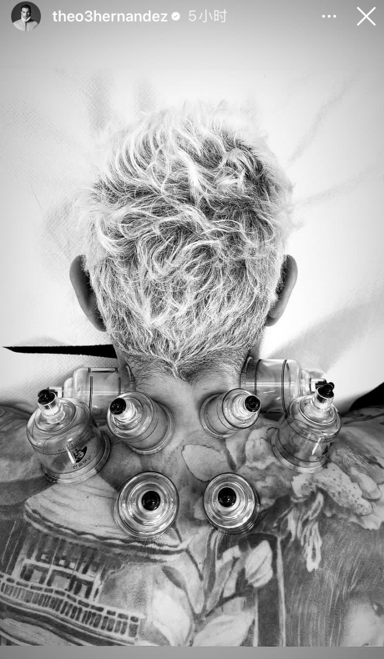  神秘東方力量加持？特奧社媒曬照，自己正在接受拔罐治療