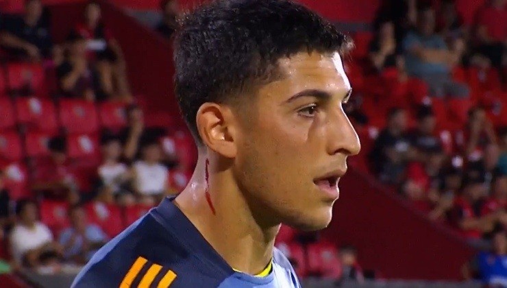  博卡門將被對方球迷丟下的玻璃劃傷脖子后流血，但他仍照常熱身